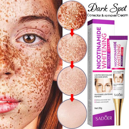 Sadoer Nicotinamide Whitening Lightening Spots Freckle Face Cream 20g